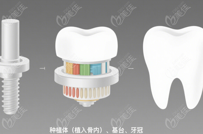 宝鸡小白兔口腔隐形义齿