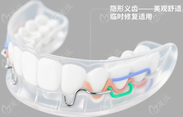 宝鸡小白兔口腔假牙收费透明度