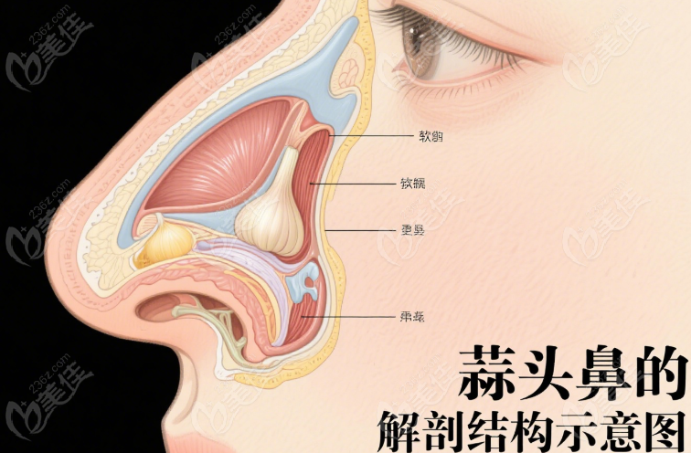 爱贝芙注射隆鼻