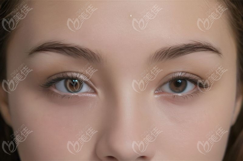 全飛秒pro和全飛秒的原理差異