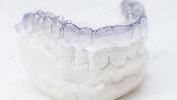 岳陽隱形矯正牙齒價(jià)格表236z.com