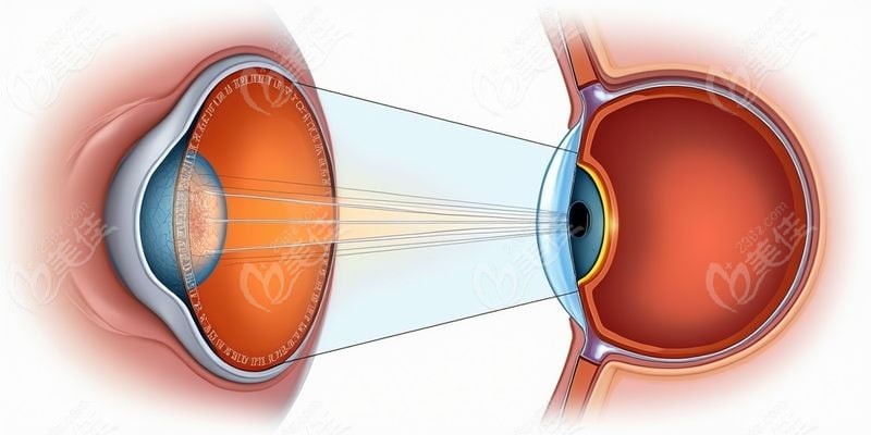 中南大學(xué)湘雅二醫(yī)院眼科概況