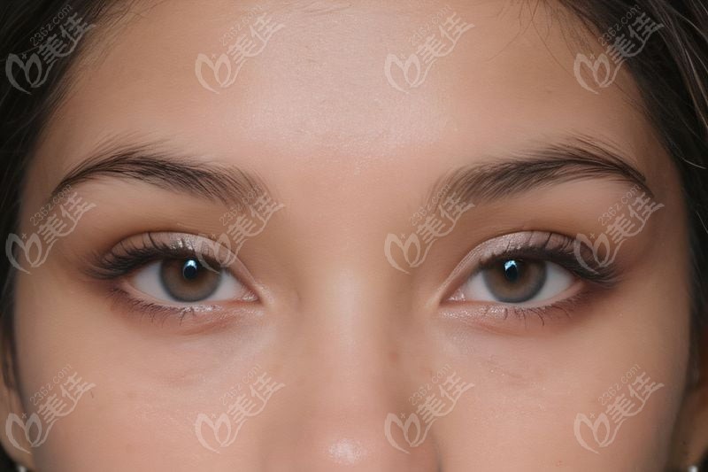 中南大學(xué)湘雅二醫(yī)院近視眼手術(shù)價(jià)格表與其他醫(yī)院對(duì)比