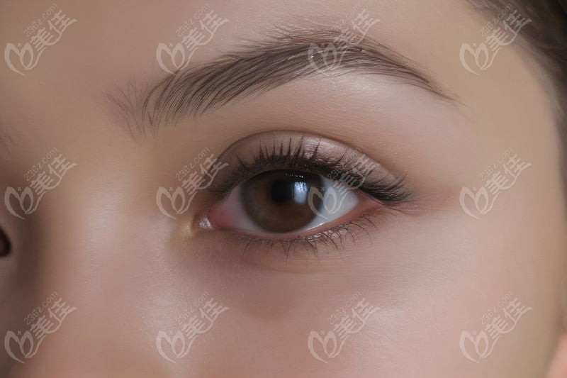 如何選擇適合自己的中南大學(xué)湘雅二醫(yī)院近視眼手術(shù)方案