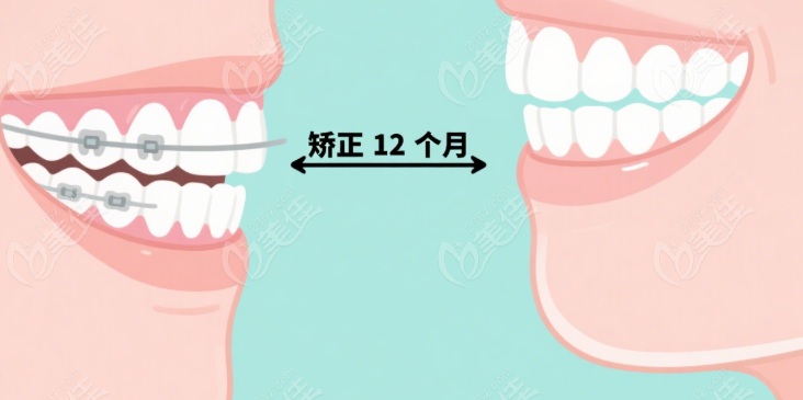 洞口雅爾康口腔牙齒矯正技術(shù)