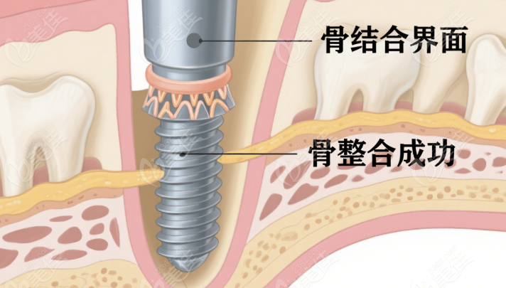雅尔康口腔优势