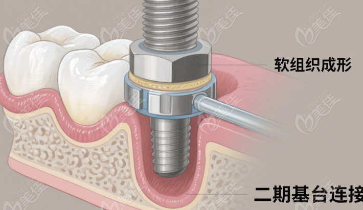 雅尔康口腔分院