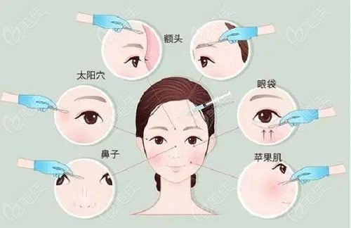 黎星取生长因子好