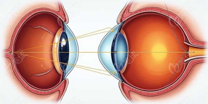 鄭大一附院眼科醫(yī)生坐診的費(fèi)用與患者評(píng)價(jià)