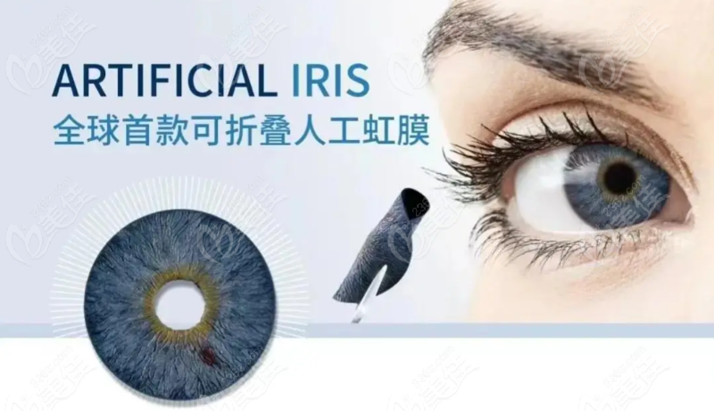 人工虹膜植入北京能做吗？