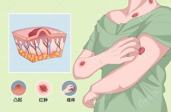 患者对于艳菊医生的真实评价