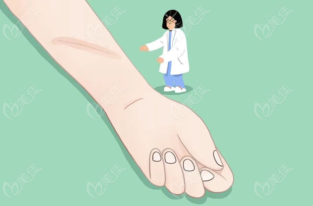 于艳菊医生祛疤技术优势