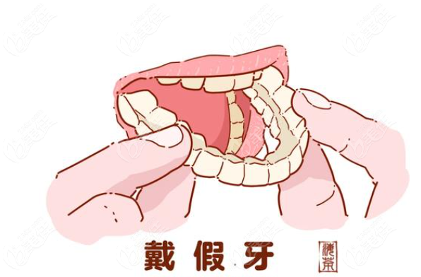 长春戴假牙价格表