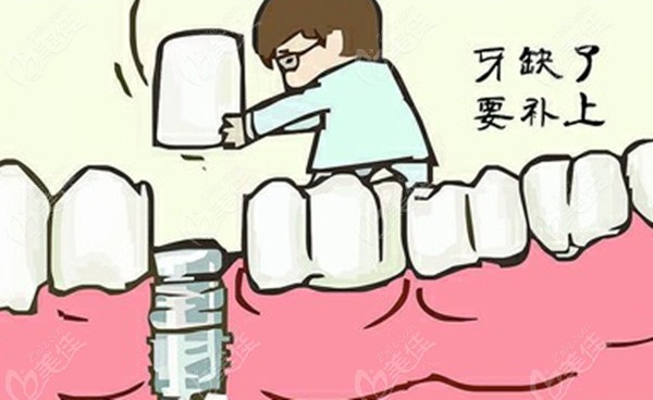 长春爱馨口腔种植牙价格不贵