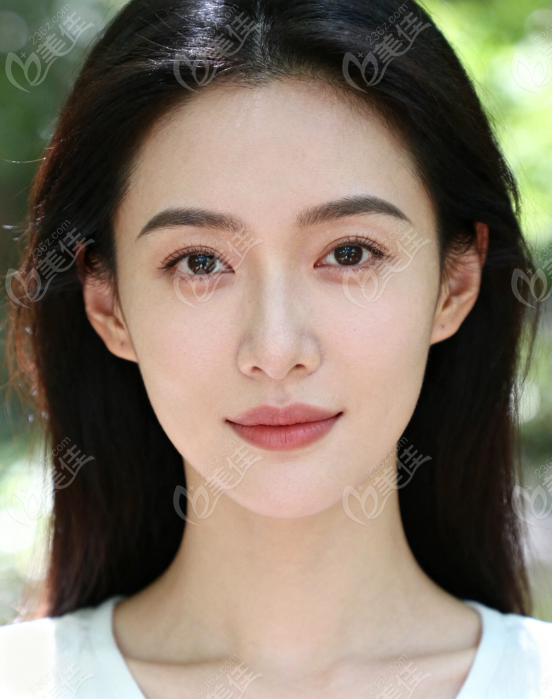 廈門周璟做雙眼皮怎么樣