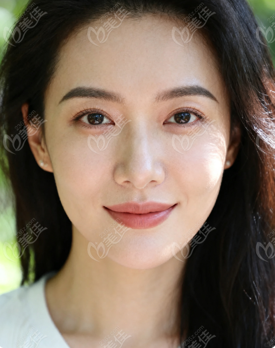 韩国海芙音聚拉提下颚线www.236z.com