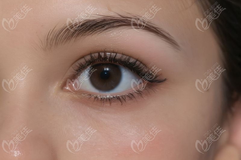 西安四院李勇醫(yī)生患者常見問題