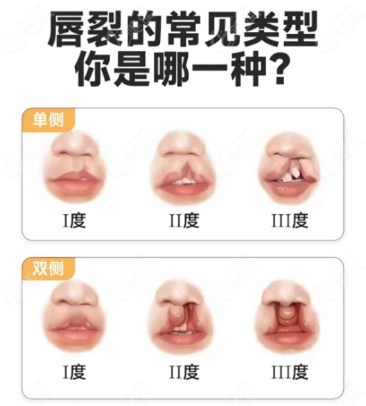 广州余文林和毛喆谁更好