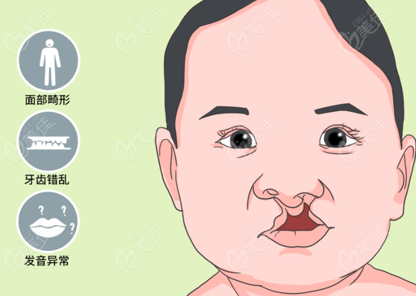广州余文林和毛喆谁腻害一点