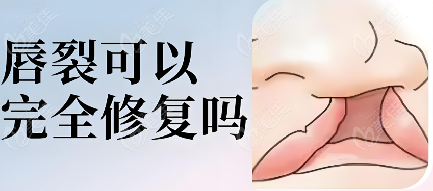 余文林唇裂修复是正规的
