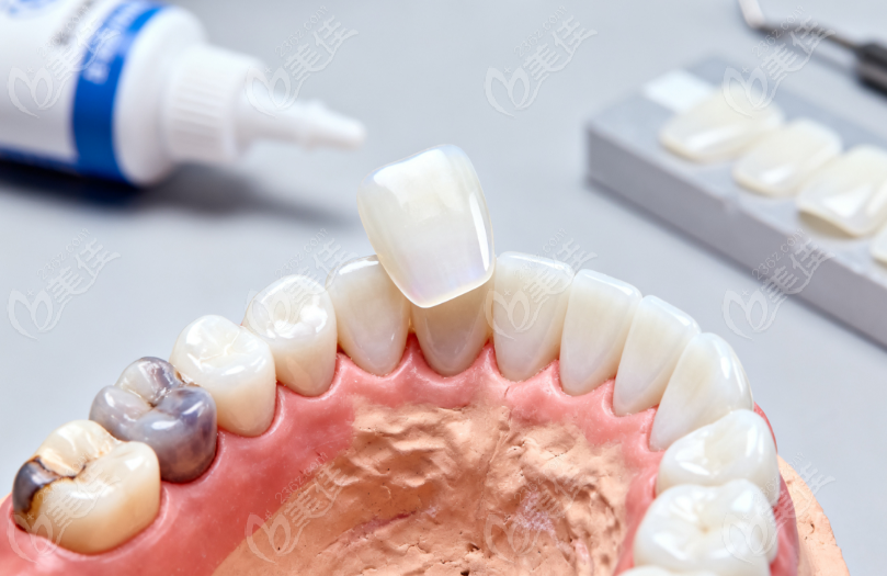 价格体系与优惠活动