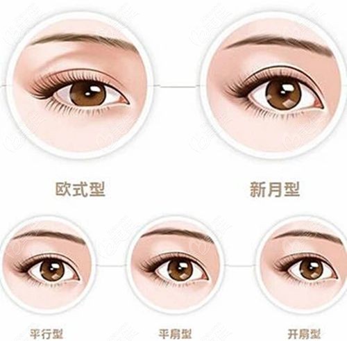 上海郑晓红修复双眼皮翻车不可信