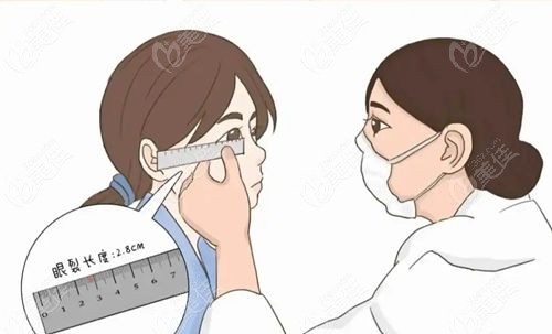 上海双眼皮修复大佬怎么选