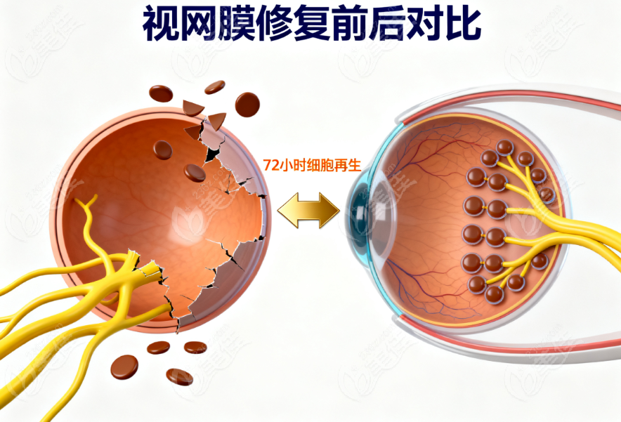 华厦眼科医院视网膜修复