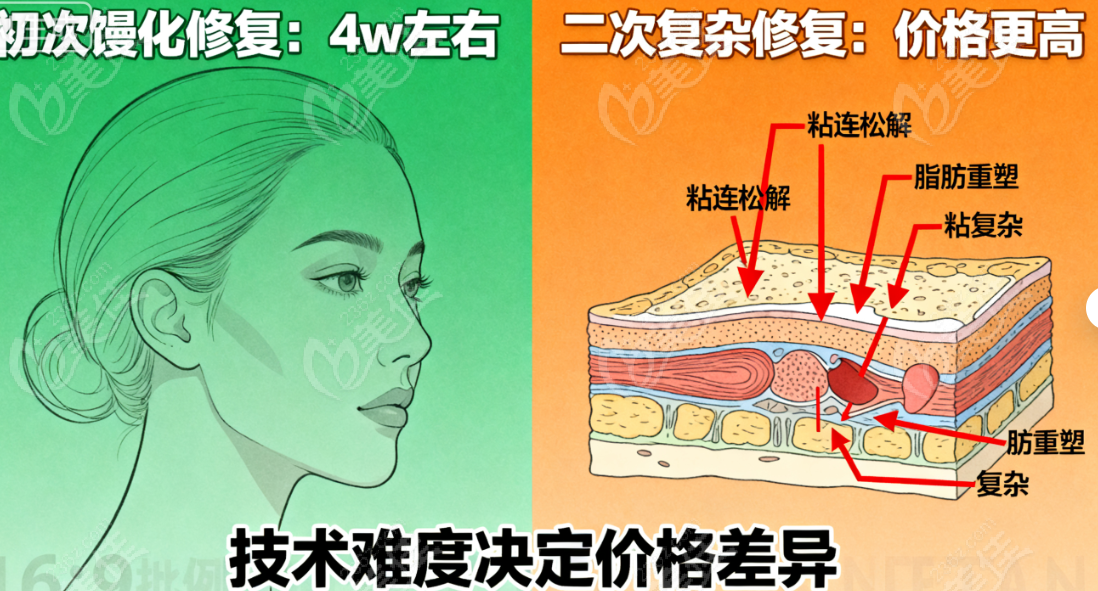 成都的白振华医生在面吸修复