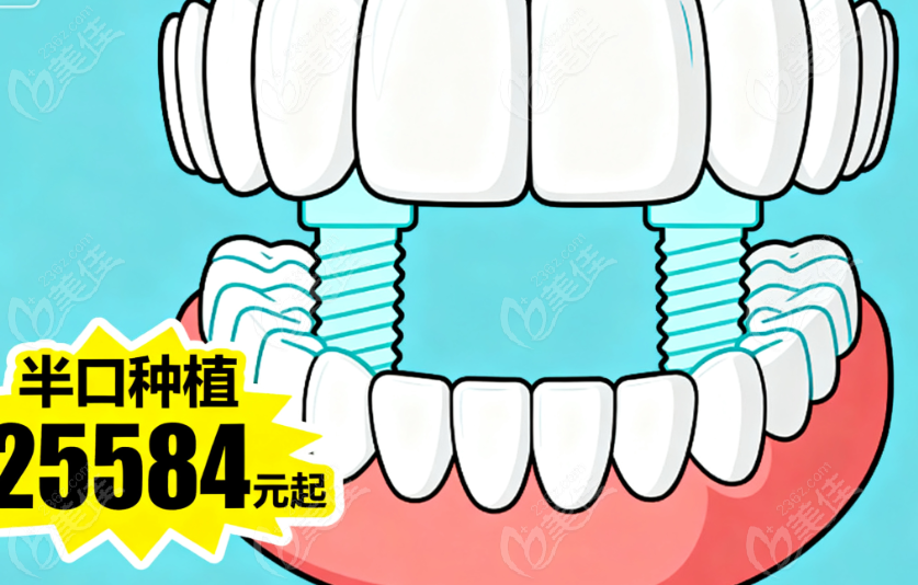 杭州深蓝口腔2025价格表