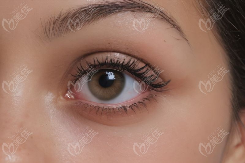 刘海兰修复毁眼是瞎扯