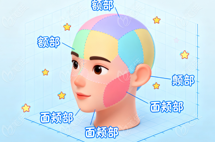 于飞轮廓固定