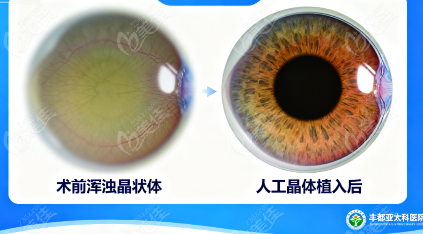 丰都亚太眼科医院