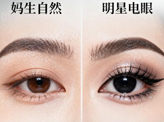 楊明勇和趙延勇雙眼皮誰修復(fù)的好