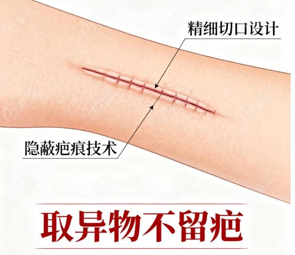 为啥这些“异物”是定时炸弹