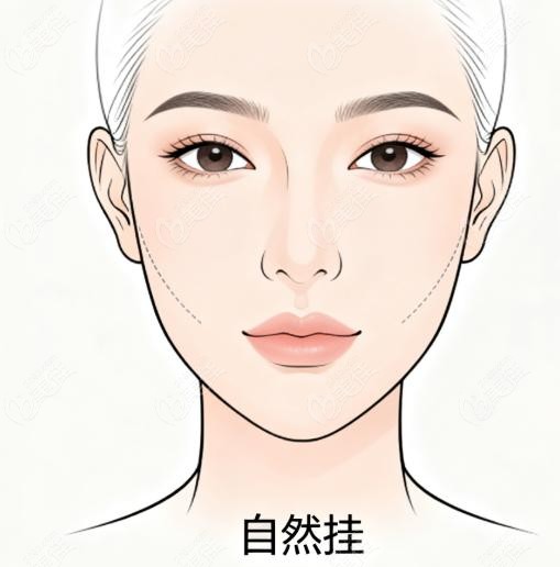 赵延勇埋线凭啥贵（1.2w-3.8w）