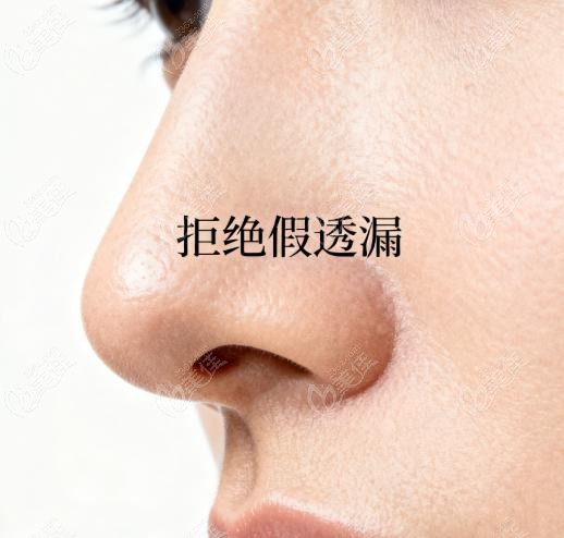 为啥“修鼻”比初鼻更难