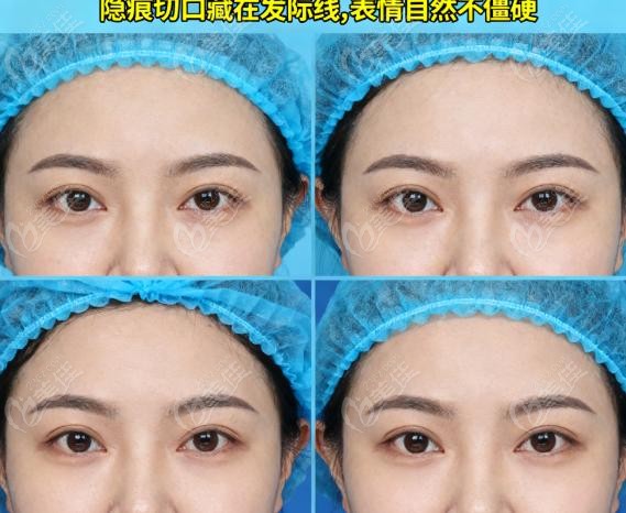 赵延勇悬吊凭啥贵（1.8w起）