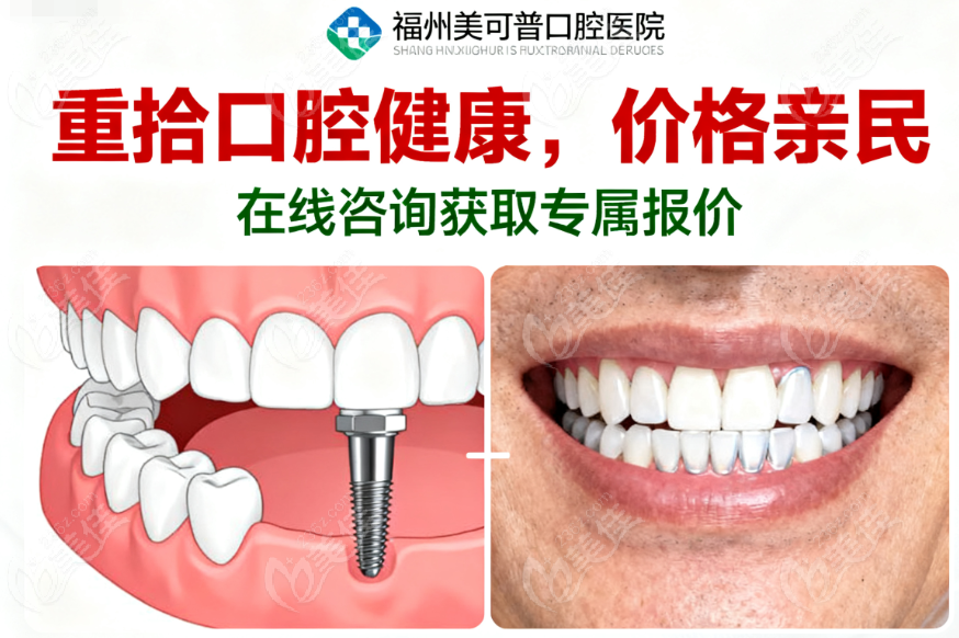 福州美可普口腔