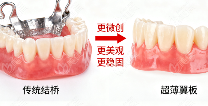 芬力桥怎么样236z.com