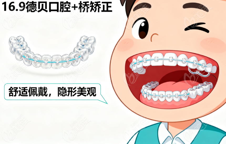 柯桥德贝口腔矫正怎么样啊