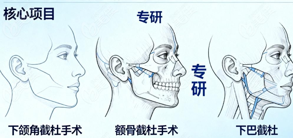 为啥轮廓手术这么“昂贵”