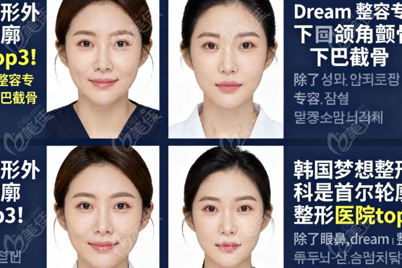 你关心的轮廓手术灵魂拷问
