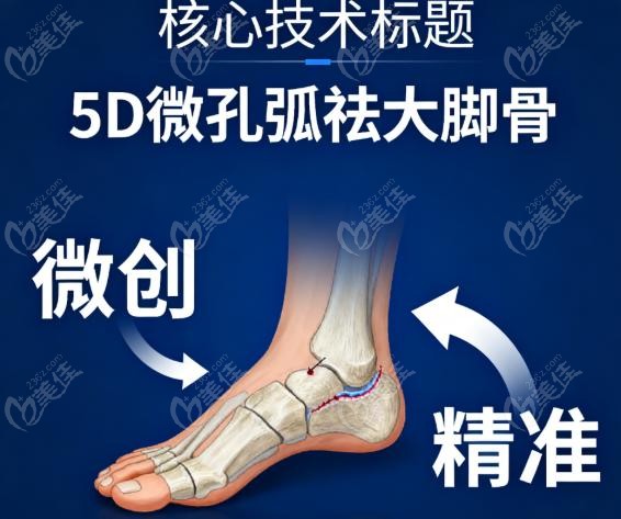 陈圣英医生5D微孔弧祛大脚骨术
