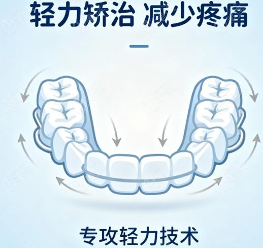 康貝佳口腔輕力矯治系統(tǒng)如何讓矯正更舒適