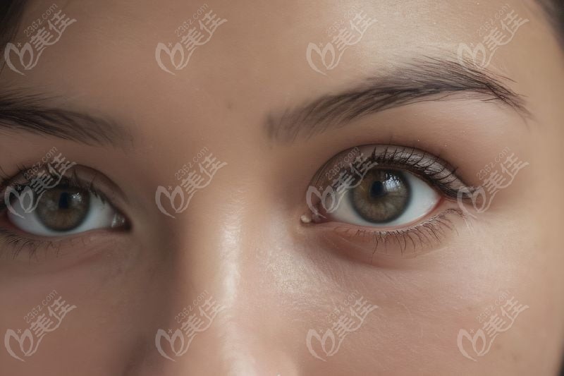 三、长春同仁眼科医院特色诊疗项目介绍