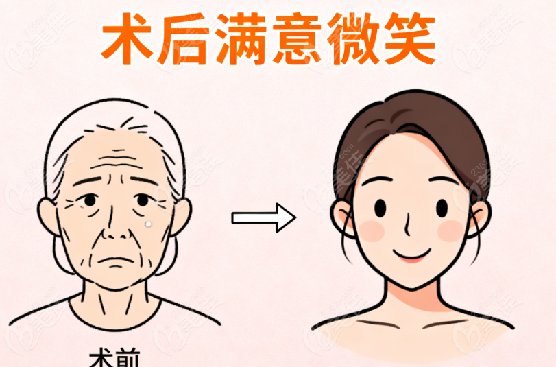赵鹏医生筋膜提升价格与性价比分析