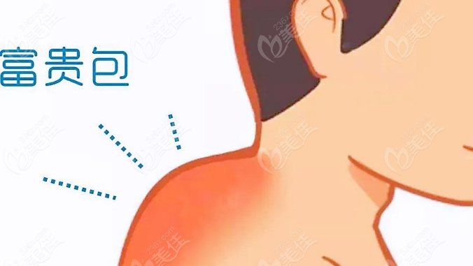 富贵包手术大盘点