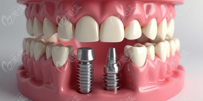 一、太原易看牙口腔門診部正規(guī)性解析