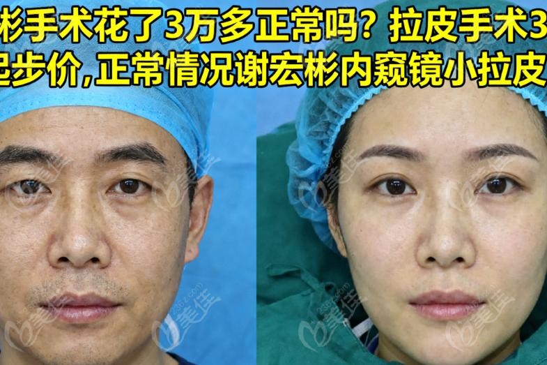 谢宏彬手术花了3万多正常吗